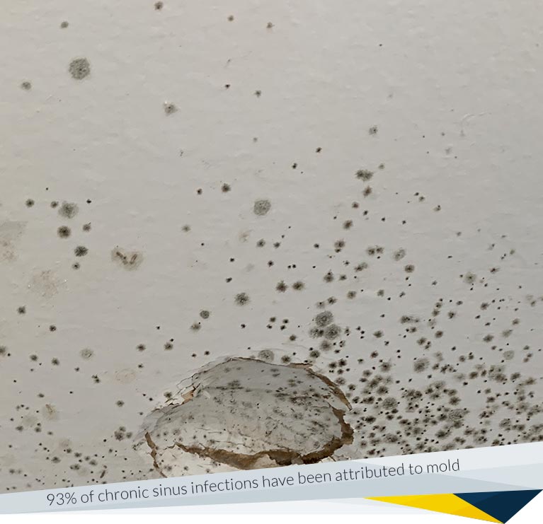 Mold Exposure: Symptoms, Diagnosis, Treatment & Prevention